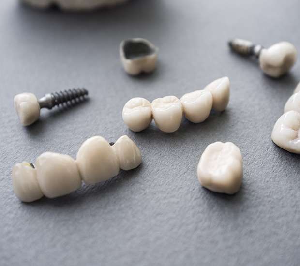 Hyattsville The Difference Between Dental Implants and Mini Dental Implants