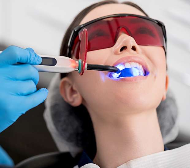 Hyattsville Professional Teeth Whitening