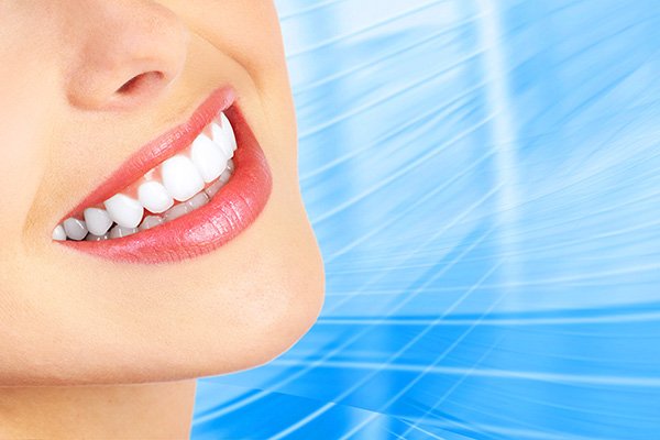 teeth whitening Hyattsville, MD